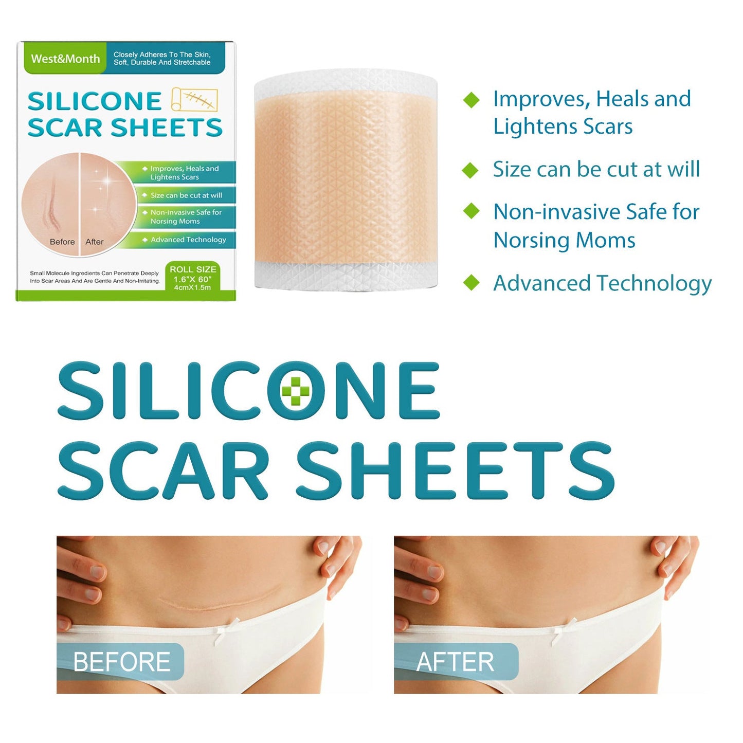 Self-adhesive Silicone Scar Paster Repair And Care Beauty Stickers