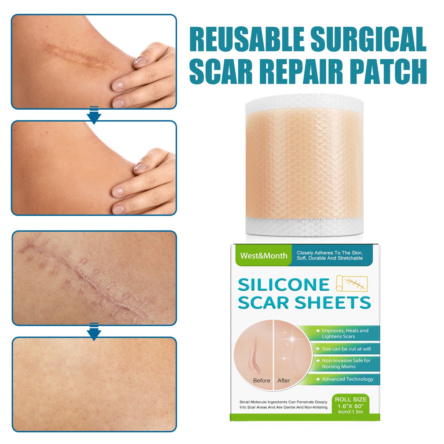 Self-adhesive Silicone Scar Paster Repair And Care Beauty Stickers